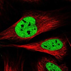 SAMD15 Antibody, Novus Biologicals 0.1mL; Unlabeled:Antibodies, Polyclonal